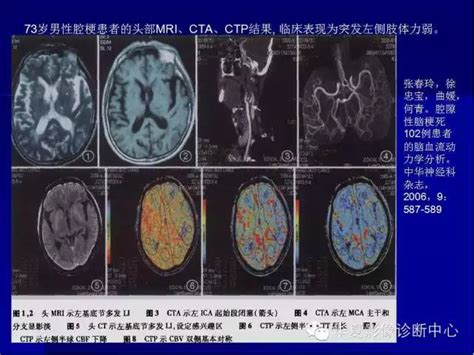 气道和肺马赛克灌注,CT灌注成像