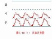 醒脉通治疗什么的,和您一起消除电击治疗的恐惧