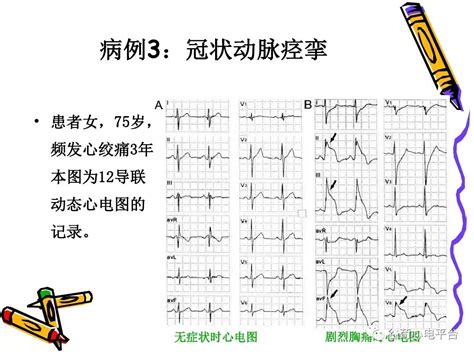 文化对经济的作用是什么,法对经济的作用是什么