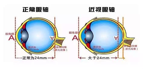 近视治疗仪,平均1分钟接诊