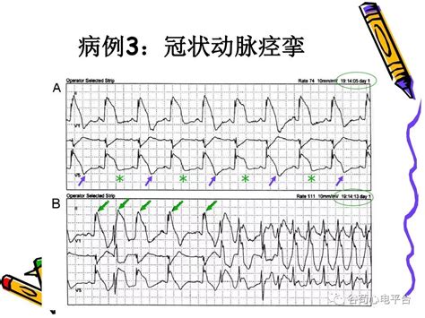 零基础如何学考研英语,两学一做如何学怎么做