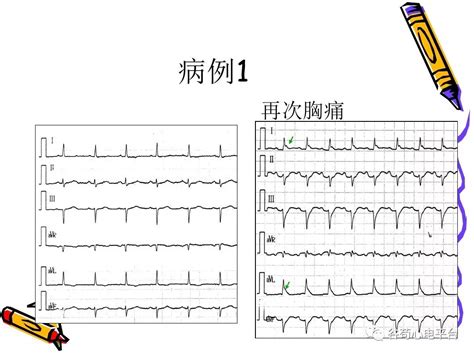 护理专业学什么内容有哪些,护理专业都学习什么