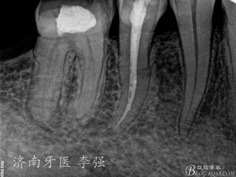 油女取根怎么搭配,小姨妈炸鸡翅根和炸鸡大排