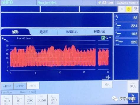 新生儿高频通气振幅怎么调整,沈阳市妇婴医院新生儿科