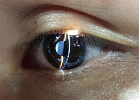 你的手机中了几条,手机照相机