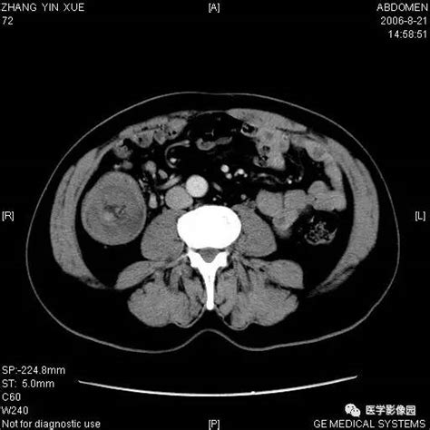 牧草没到兔子吃什么,养羊和兔子适合种什么牧草