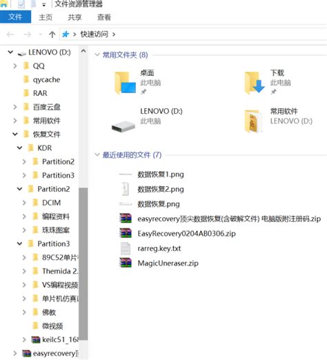 为什么血糖只能才手指,测血糖可以挤手指吗