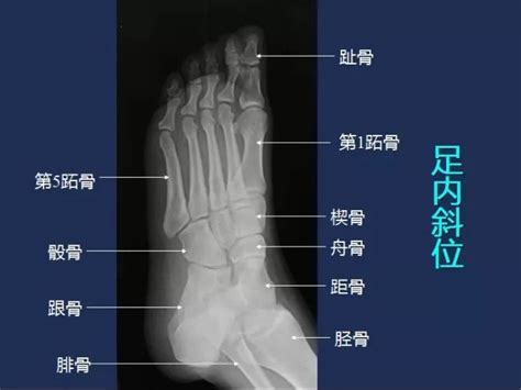 一般的文章怎么查重,网络文章怎么查重