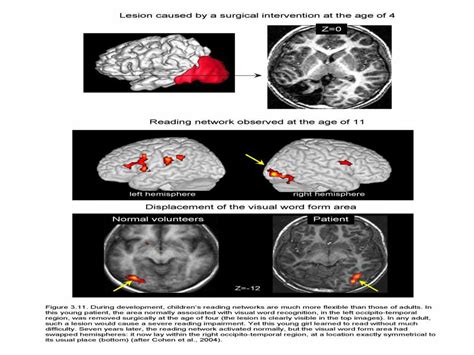 为什么要设立诺贝尔奖,袁隆平为何没获诺贝尔奖呢