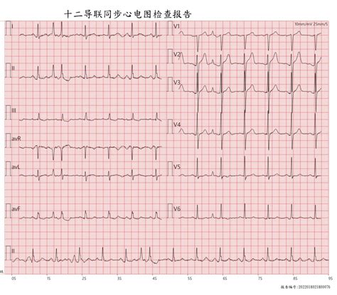 立体心电图有什么用,B超到底有什么区别