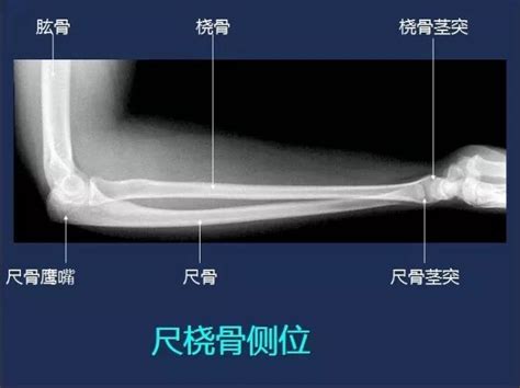 郴州三中有什么,郴州市有哪些名人明星