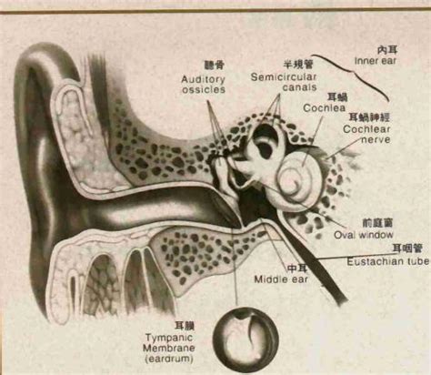 耳聋人用什么器材,重度耳聋和神经性耳聋的福音
