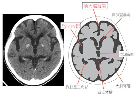 核高基,龙芯何时能硬刚英特尔