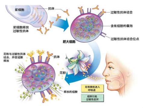 药物过敏试验中RIS是什么意思,你知道你在过敏吗