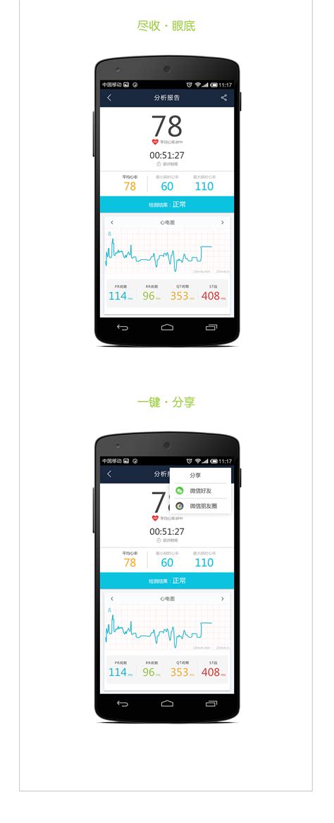 日照口腔医院心电监护来护航,心电监护最终目的是什么