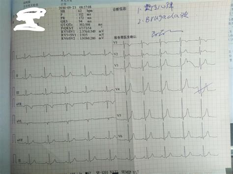 立体心电图有什么用,B超到底有什么区别