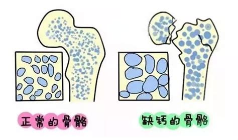 产后缺钙会怎么样,狗狗产后缺钙急救办法有哪些