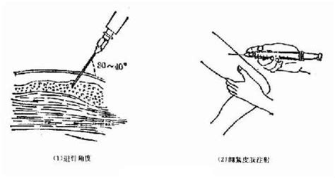 新冠疫苗为什么肌肉注射,疫苗为什么打肌肉注射