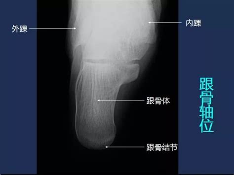 小学应用文格式,学习应用文有什么作用