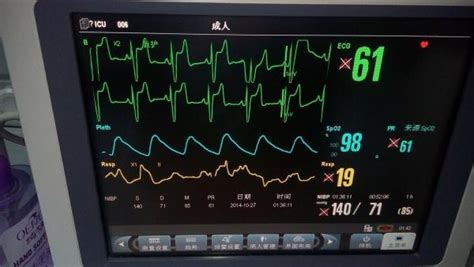 电子病例心电监护怎么开,家用版创可贴式心电监护仪