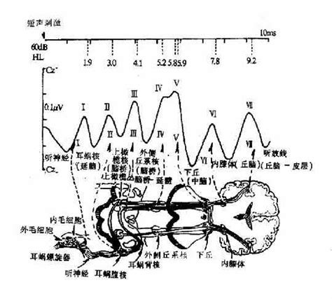 广梅开发区医院来了辆巨无霸,电测听室