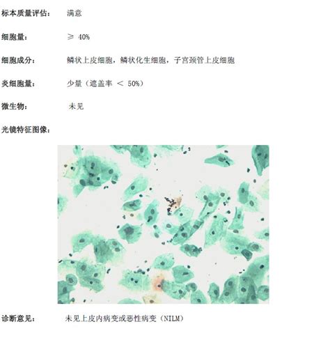 宫颈液基细胞项目都有 怎么回事,HPV检查是怎么做的