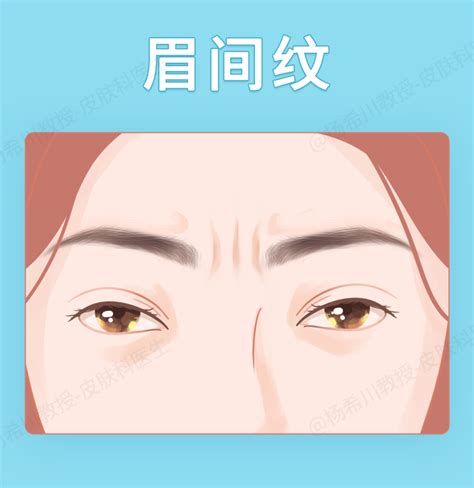 为什么会出现僵尸肉,冷冻肉全是僵尸肉吗