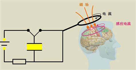 经颅磁刺激TMS.ppt,tms经颅磁刺激