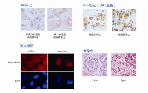 新闻学包括什么专业,新闻学专业学什么