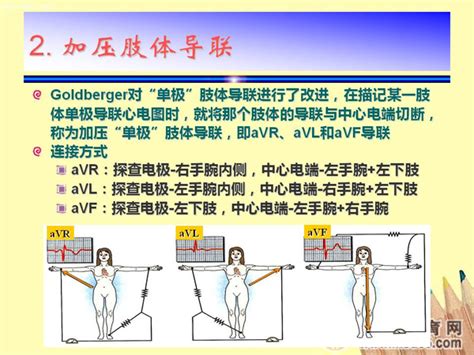 心电图机十二导联分别接在什么位置,12导联心电图摆放位置