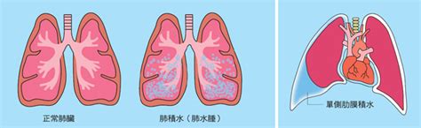 狗肺积水什么症状,了解犬心脏病的症状