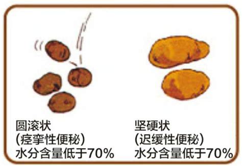 浅谈根管治疗失败的原因,长期软便是什么原因