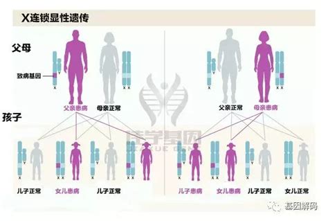 进行性肌营养不良消息,杜氏肌营养不良