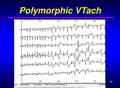 polymorphic,Polymorphic