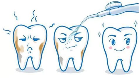 为什么刷牙牙龈出血,为什么每天刷牙