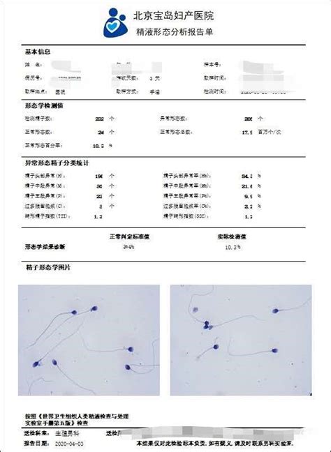 了解什么是单招,高考单招是什么意思